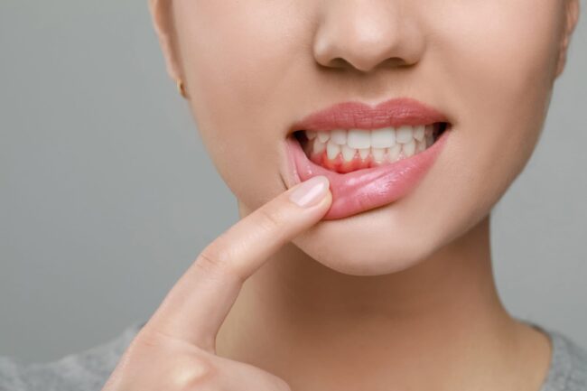 Woman showing inflamed gum on grey background, closeup periodontal disease