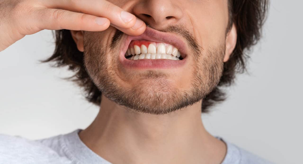 Tooth sensitivity 
