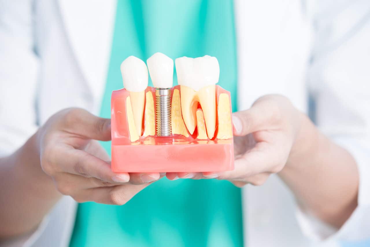 woman dentist take implant tooth on the blue background